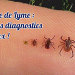 Maladie de Lyme : 80 % des diagnostics sont faux !